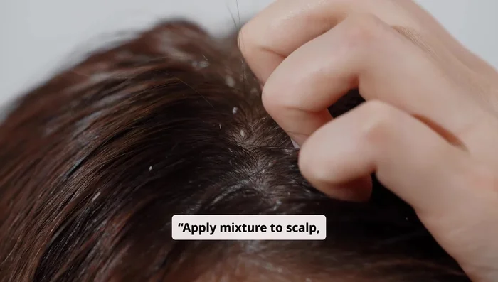 Apply the mixture to your scalp, paying particular attention to itchy or flaky areas.